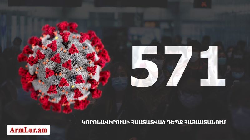 Հայաստան. «Քորոնա»ով վարակուածներուն թիւը հասաւ 571-ի
