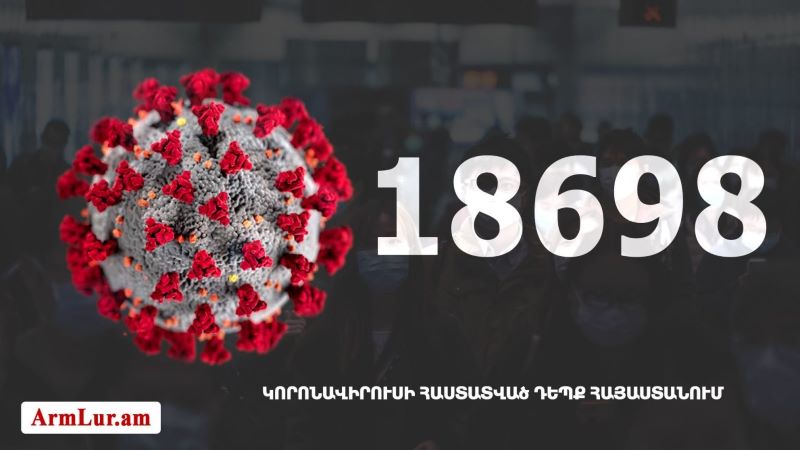 Հայաստանի մէջ «Քորոնա» ժահրով հիւանդներու թիւը հասաւ 18 698-ի