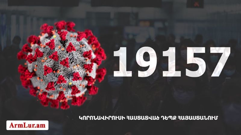 Հայաստանի մէջ «Քորոնա» ժահրով հիւանդներու թիւը հասաւ 19 157-ի