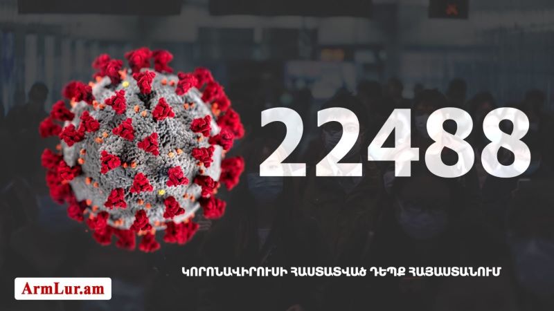 Հայաստանի մէջ «Քորոնա» ժահրով հիւանդներու թիւը հասաւ 22 488-ի