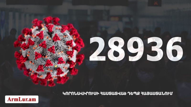 Հայաստանի մէջ «Քորոնա» ժահրով հիւանդներու թիւը հասաւ 28 936-ի