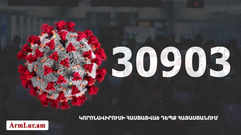 Հայաստանի մէջ «Քորոնա» ժահրով հիւանդներու թիւը հասաւ 30 903-ի
