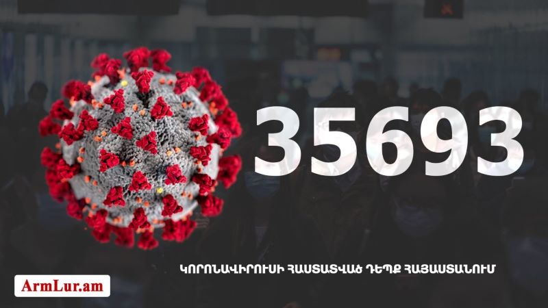 Հայաստանի մէջ «Քորոնա» ժահրով հիւանդներու թիւը հասաւ 35 693-ի