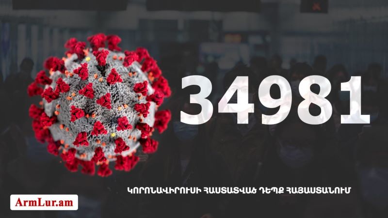 Հայաստանի մէջ «Քորոնա» ժահրով հիւանդներու թիւը հասաւ 34 981-ի