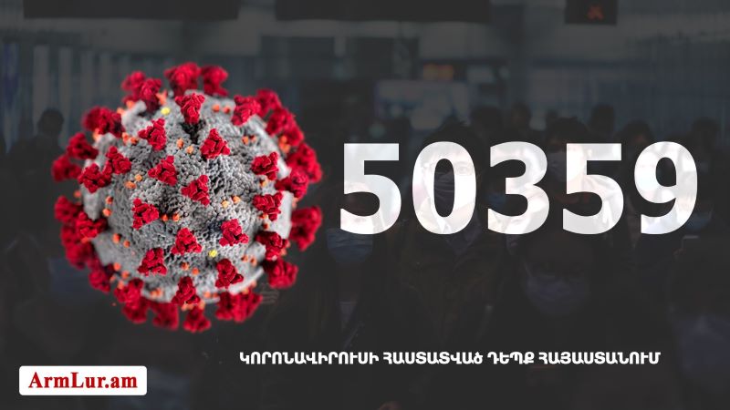 Հայաստանի մէջ «Քորոնա» ժահրով հիւանդներու թիւը հասաւ 50 359-ի